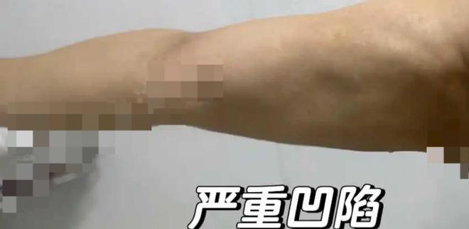 艺星品牌成赞扬“大户”深圳艺星医疗美容病院被记者起底！(图6)