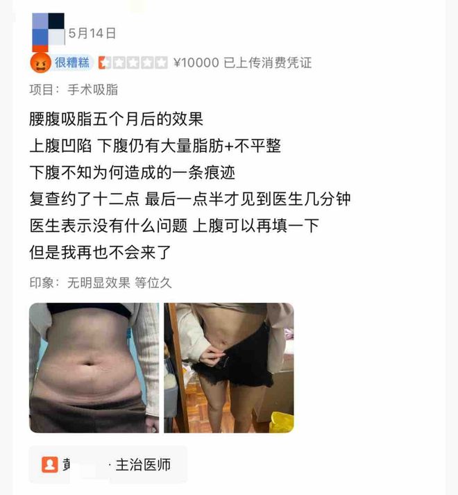 艺星品牌成赞扬“大户”深圳艺星医疗美容病院被记者起底！(图5)